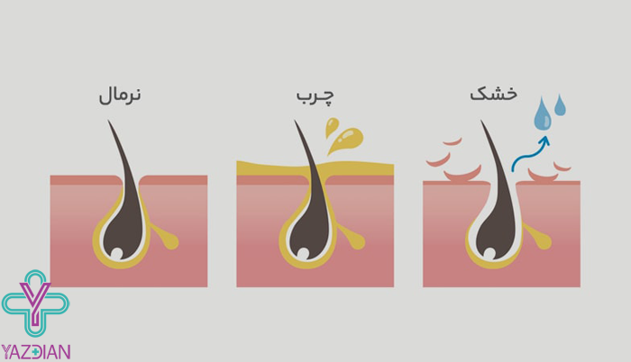 شامپو موهای چرب